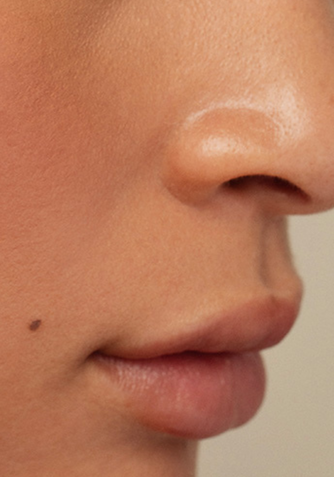 Ultraceuticals skincare that transforms skin
